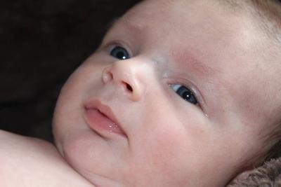 新生儿癫痫症状有哪些