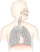 肺纤维化种类有哪些 肺纤维化是如何得的