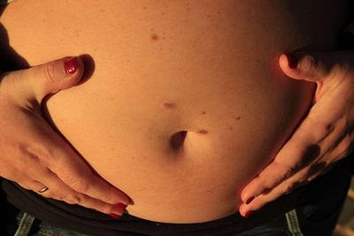 ​妊娠阑尾炎怎么办