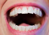 牙齿矫正磨牙的过程是怎样的 牙齿有问题需要及时矫正治疗