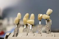 种植牙有什么后遗症 种植牙的材料有哪些