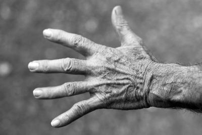 手和手臂抽搐是癫痫发作的症状吗