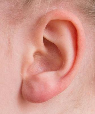 经常有耳鸣是怎么回事？