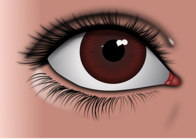 手术祛眼袋的方法有什么