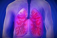 肺癌晚期很灵的中药方  如何护理晚期肺癌患者