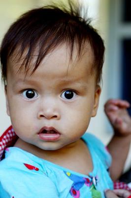 12个月宝宝癫痫怎么治疗呢