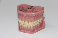 补牙对牙齿有危害吗 补牙注意事项是哪些呢