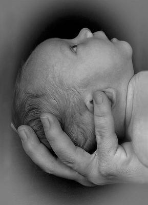 新生儿癫痫的表现形式有什么