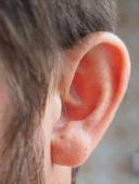 耳螨和外耳炎有哪些区别 从3方面分辨耳螨和外耳炎