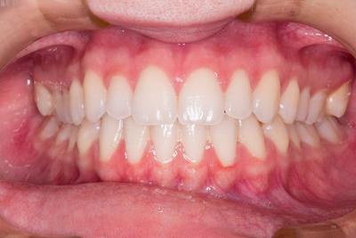 ​盘点：老年人牙齿保健六大误区