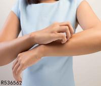荨麻疹怎么快速治疗 荨麻疹引起的原因是什么