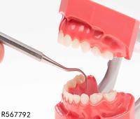牙龈老出血是怎么回事 从四方面解答牙龈出血原因