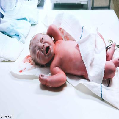 新生儿缺氧后果及护理