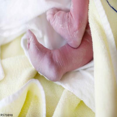 宝宝脚冰凉是什么原因 四个原因会导致宝宝脚冰凉