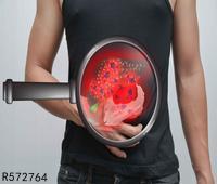 详解胃贲门癌的症状有哪些 胃贲门癌如何治疗