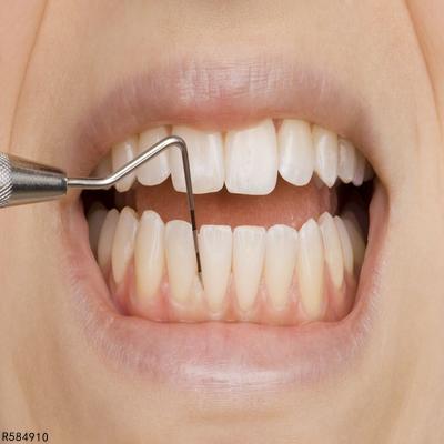 单颌牙列缺失的修复方法有哪些