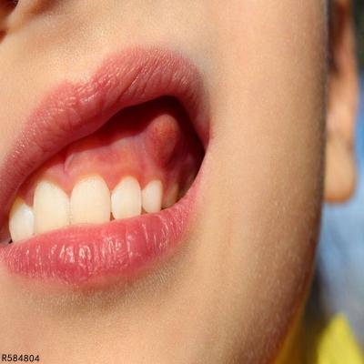 导致患者出现局部感染的危害,引起牙龈上长脓包或者严重的牙齿疼痛感