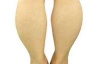 双下肢凹陷性水肿处理 双下肢凹陷性水肿怎么预防