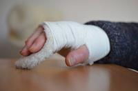 手指关节扭伤怎么办 关节扭伤的表现
