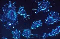 癌细胞干性是什么 介绍癌细胞的相关知识