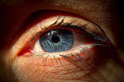 ​忽视黑眼圈易诱发五大疾病