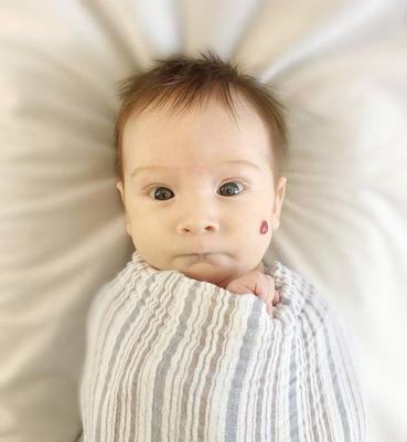 婴幼儿血管瘤如何治呢