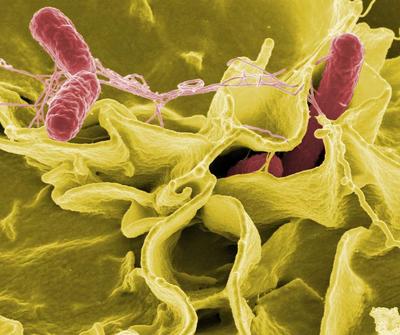 ​白带细菌感染应该怎么办呢？
