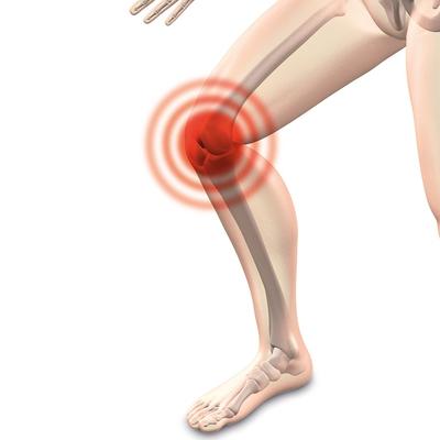 ​预防膝关节骨性关节炎的方法有哪些