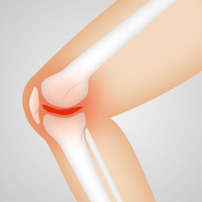 ​老年性膝关节炎怎么治疗？