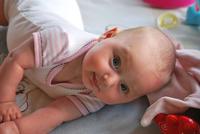新生儿头上血肿多久能消 新生儿头上血肿有哪些表现