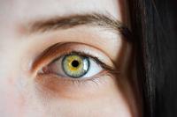 哺乳期得红眼病怎么办 红眼病的原因有哪些呢