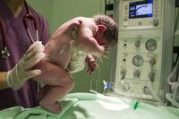 早产儿颅内出血的部位 导致新生儿颅内出血的原因