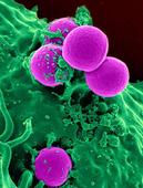 嗜酸性粒细胞增多或减少的疾病类型