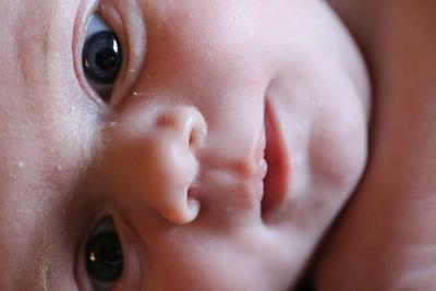 新生儿脐炎 宝宝出现脐炎怎么办