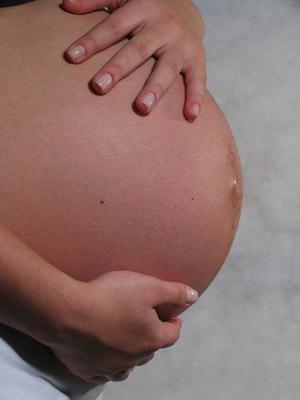 怀孕期间妊娠纹痒怎么办呢？