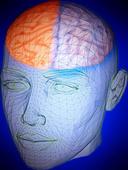 脑梗塞针灸多久一疗程 怎么预防脑梗塞