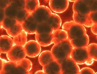 预防水痘最有效的方法有哪些  感染水痘该如何治疗