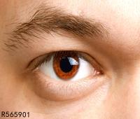 青光眼眼睛是什么颜色  青光眼眼睛有什么不同