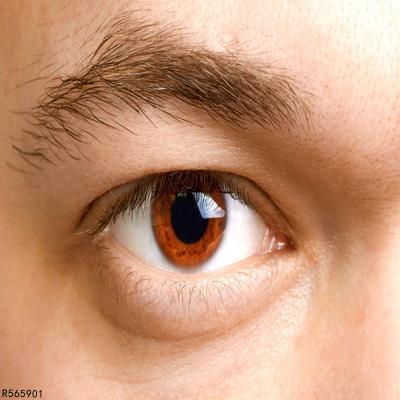 急性青光眼的治疗方法有哪些