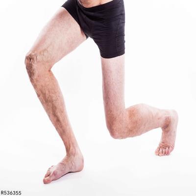 ​老人腿痛可能是外周血管有病