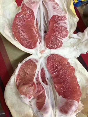 怎样才能不长子宫息肉 c21c2a92980ea66153e34c53b9f6779b_565676_400x400.jpg