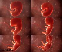 胎儿窘迫能顺产吗  胎儿窘迫怎么办 