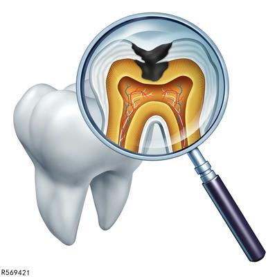 孩子蛀牙对身体有什么危害呢
