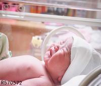 新生儿长奶癣怎么办 引起婴儿奶廯的病因