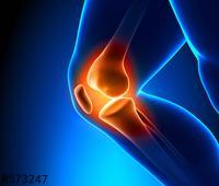 膝盖关节炎是回事 引发膝盖关节炎6大原因