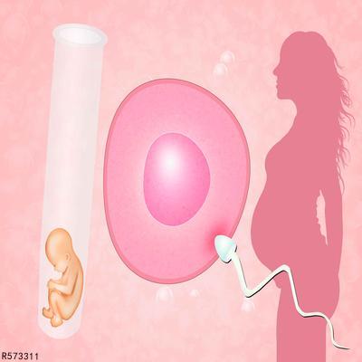 什么是空卵泡？做试管婴儿取到空卵泡的几率大吗？
