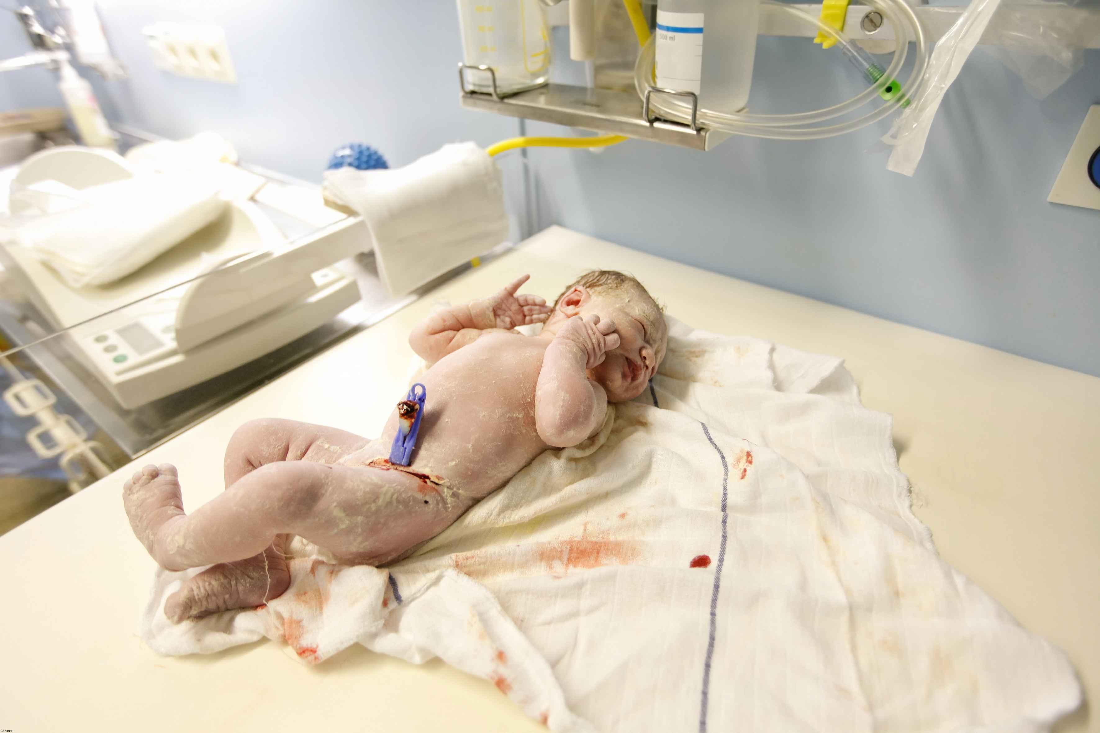 新生婴儿的一般体长新生婴儿的将康标准