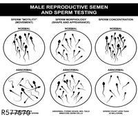 压力过大会降低精子质量 如何提高男性精子质量