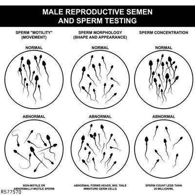 精子畸形率高也女性可以怀孕