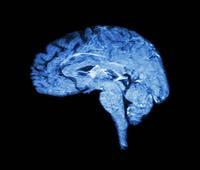 小脑萎缩是什么病，有哪些表现？